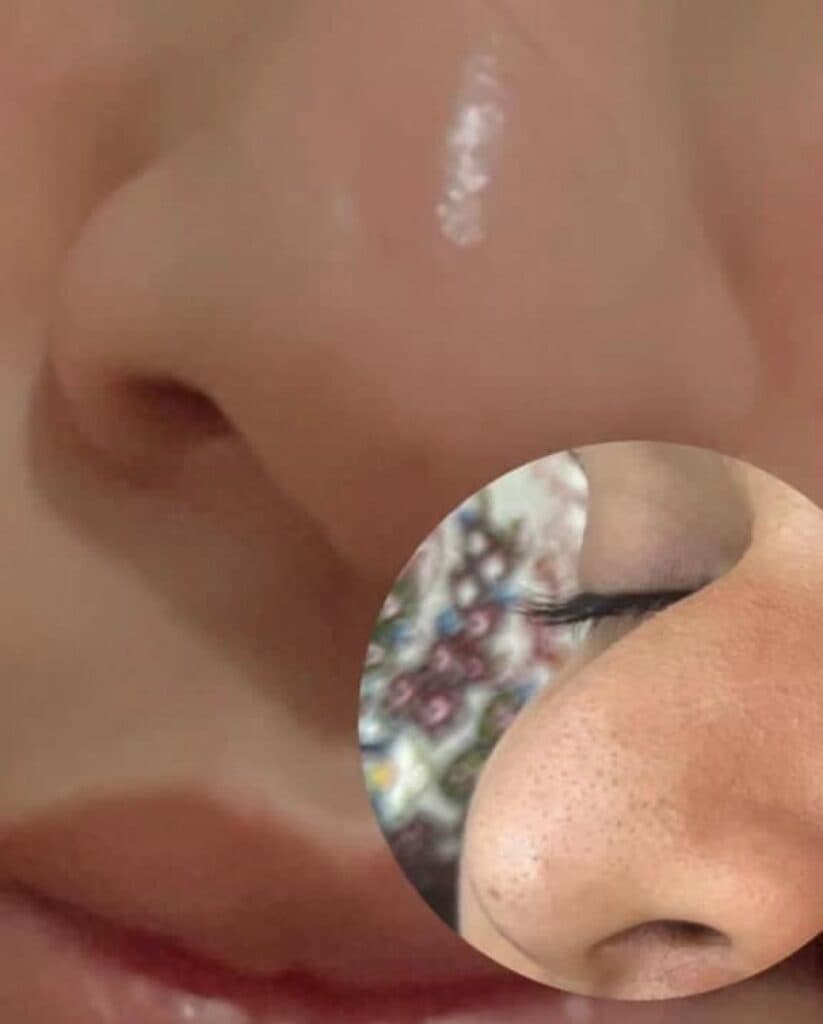 خدمات زیبایی فشیال کراتین صافی و احیا و لیفت ابرو نازگل در بندرعباس