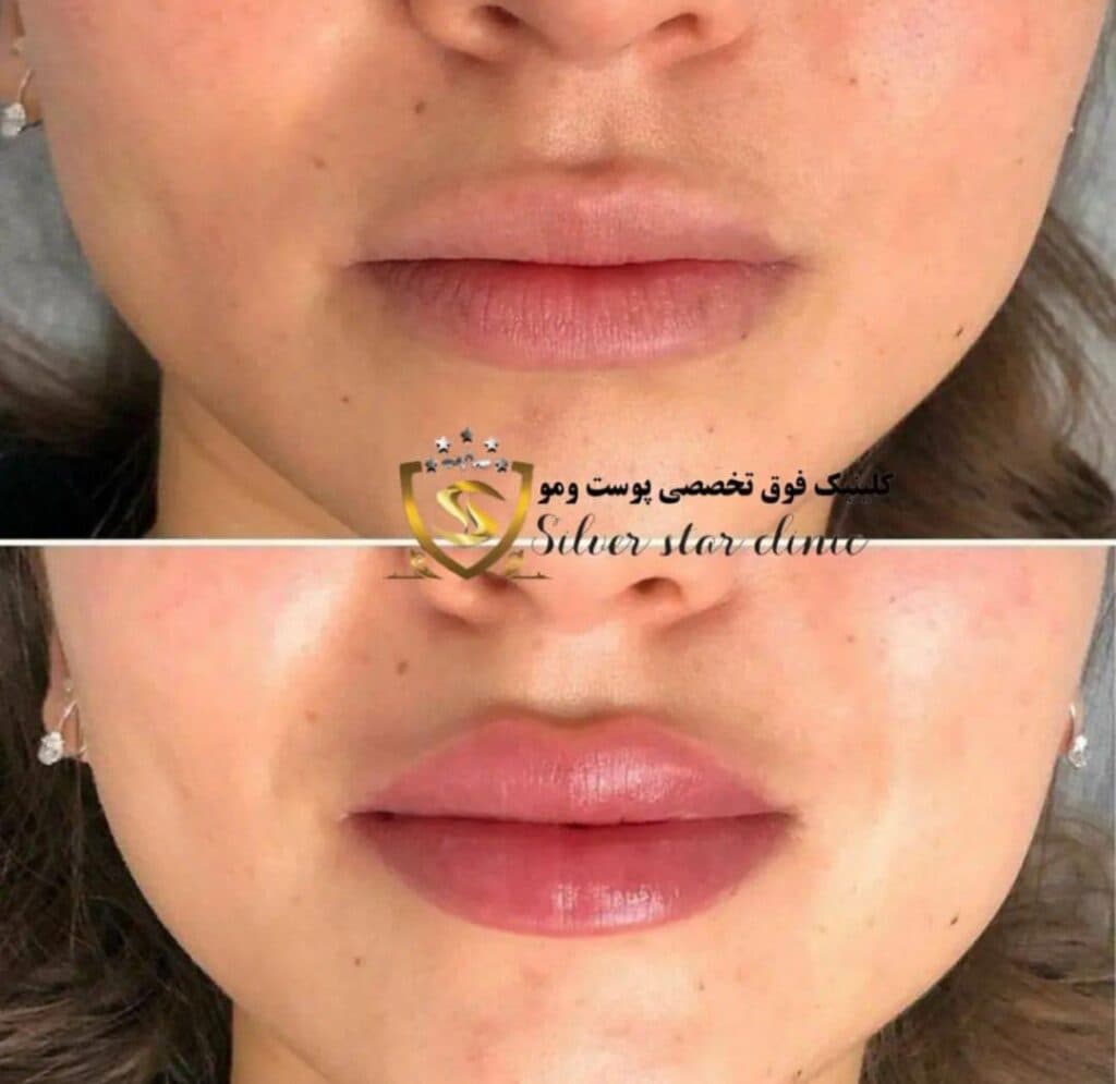 کلینیک زیبایی کاشت مو و ابرو ستاره نقره ای Silver star در شریعتی تهران