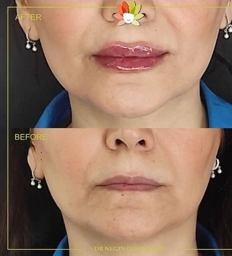 مطب زیبایی پوست و مو دکتر نگین گلپریان در مهرشهر کرج