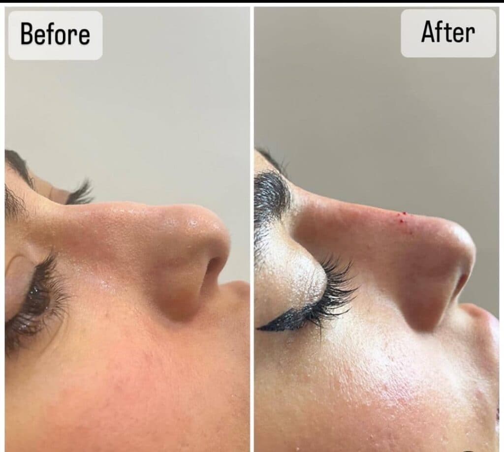 کلینیک زیبایی هیلدا در تهرانپارس تهران