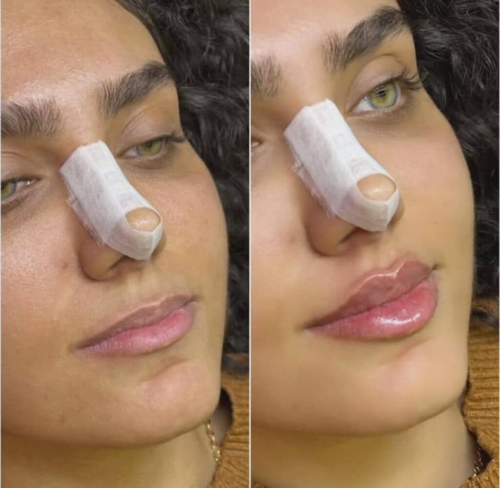 کلینیک زیبایی هیلدا در تهرانپارس تهران