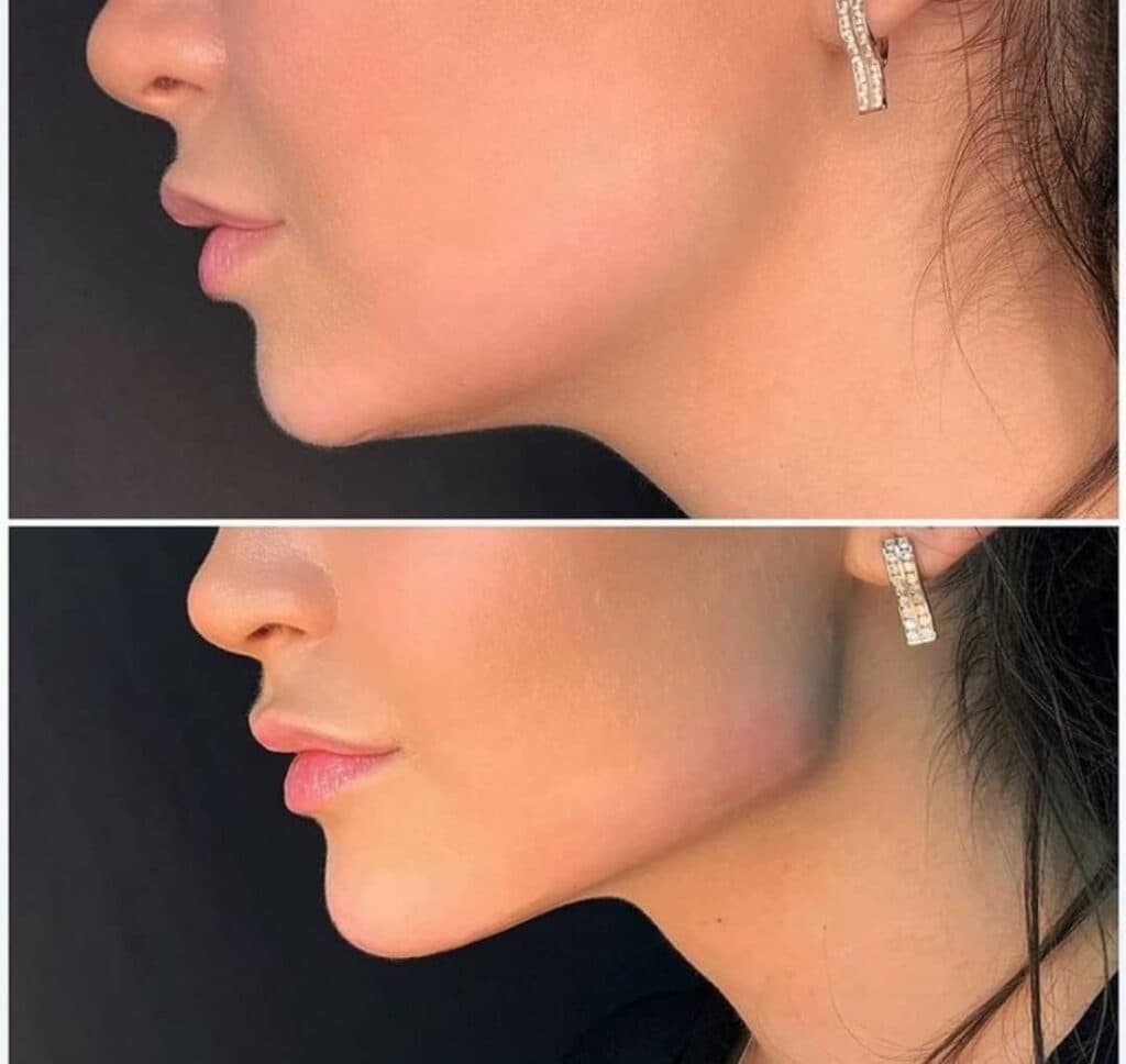 کلینیک لیزر پوست و مو زیبایی ماری اسکین در هفت حوض تهران