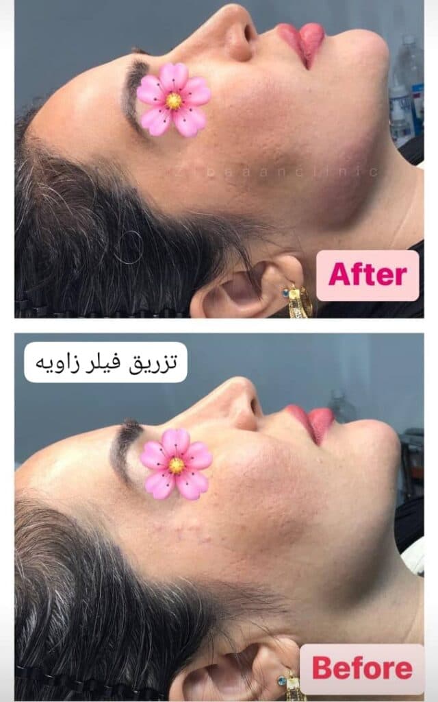 کلینیک زیبایی پوست و مو زیبان در نورآباد