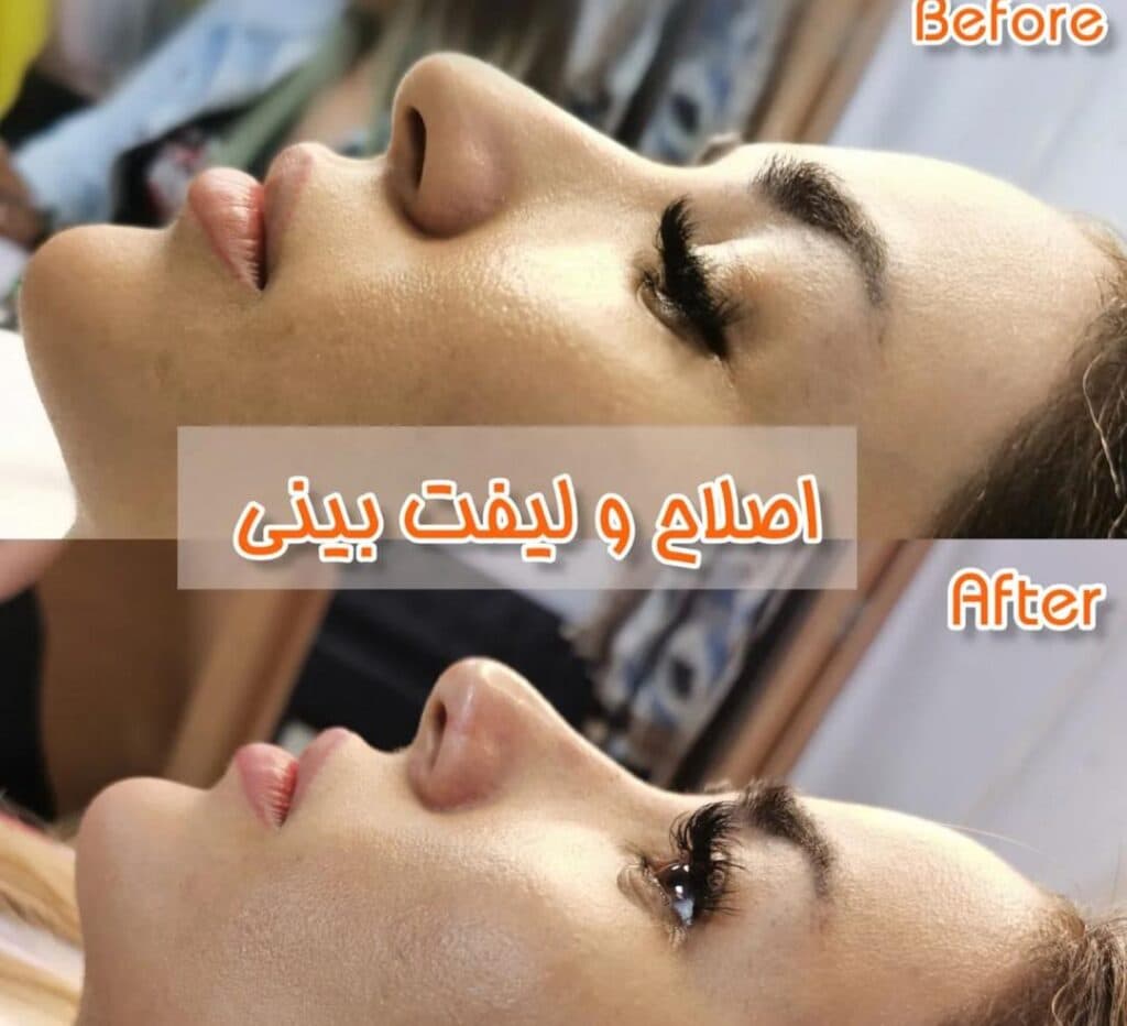 کلینیک زیبایی و خدمات زیبایی بوتاکس و ژل و لیزر دماوند در صدرا شیراز