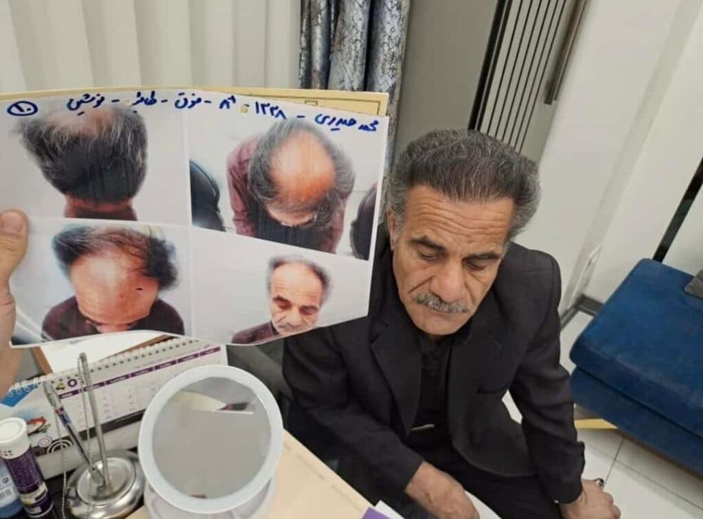 کلینیک زیبایی کاشت مو و ابرو ستاره نقره ای Silver star در شریعتی تهران