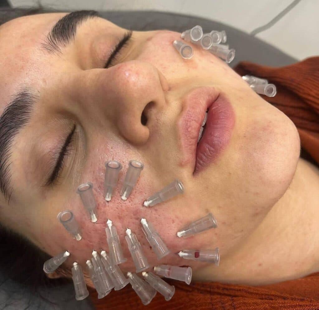 کلینیک زیبایی هیلدا در تهرانپارس تهران