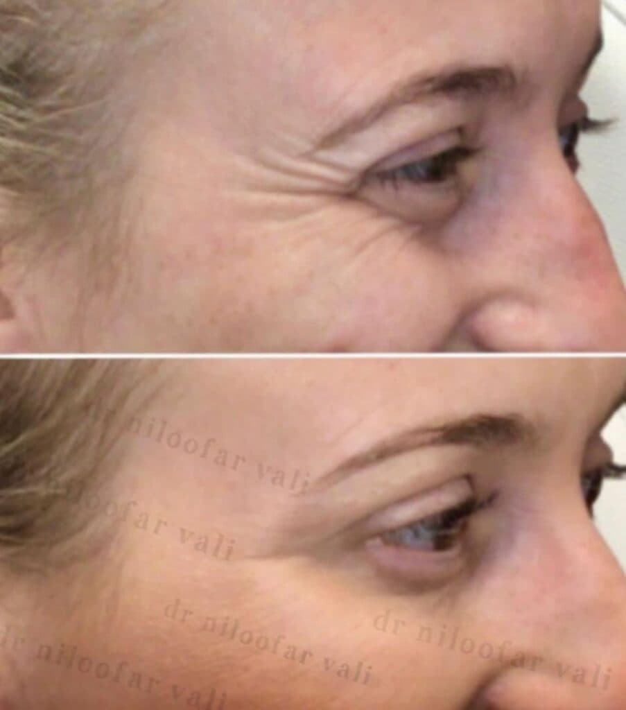 کلینیک کاشت مو و ابرو دکتر نیلوفر والی در ولنجک تهران