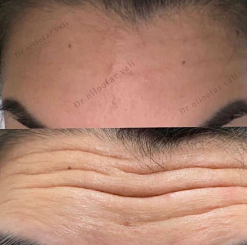 کلینیک کاشت مو و ابرو دکتر نیلوفر والی در ولنجک تهران