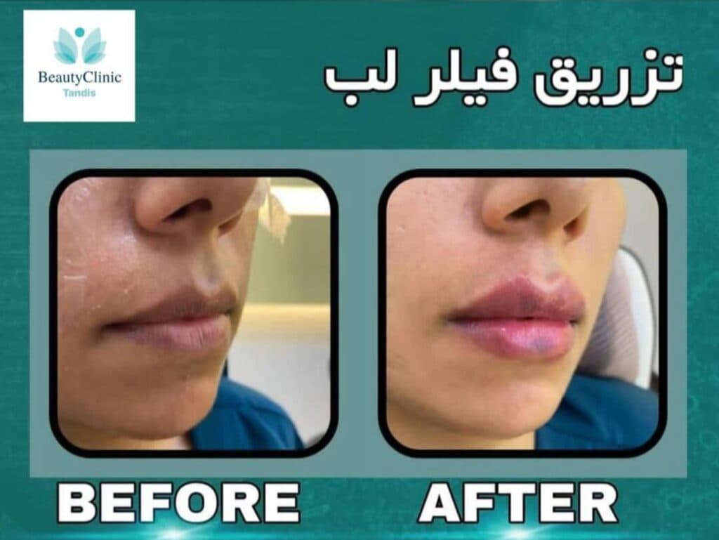 کلینیک پوست و مو و لیزر تندیس در فرهنگ شهر شیراز