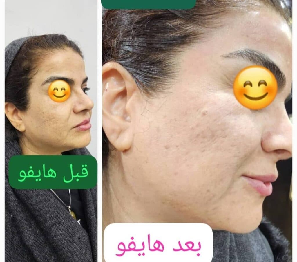 کلینیک تخصصی پوست و مو آتریسا در شیراز