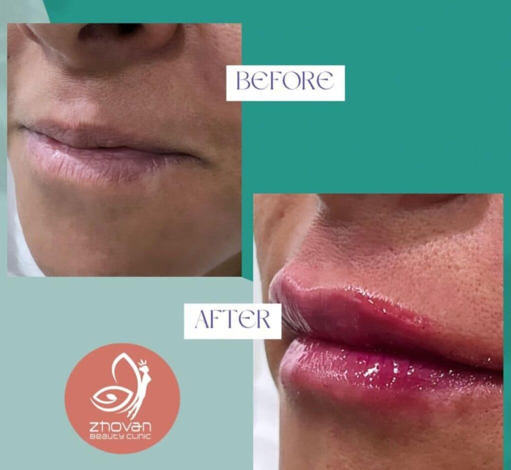 کلینیک تخصصی زیبایی ژوان Zhovan در قدوسی غربی شیراز