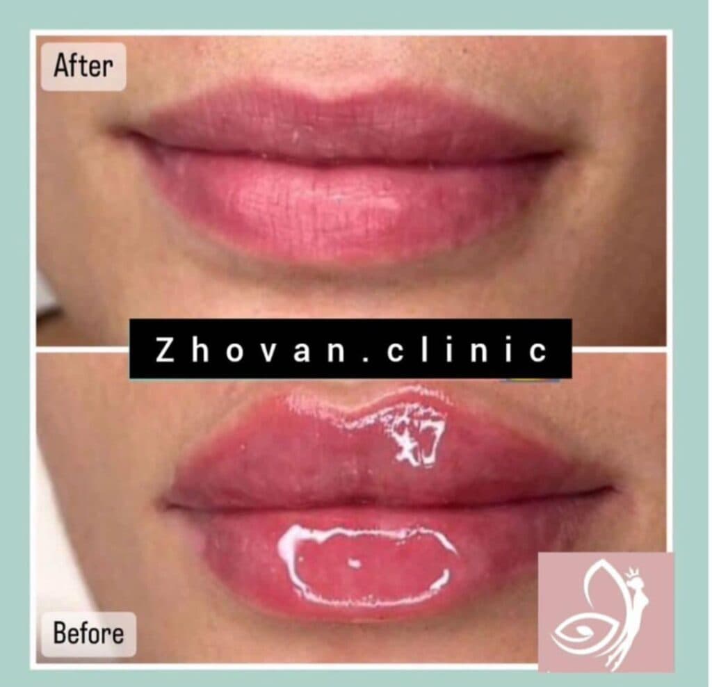 کلینیک تخصصی زیبایی ژوان Zhovan در قدوسی غربی شیراز