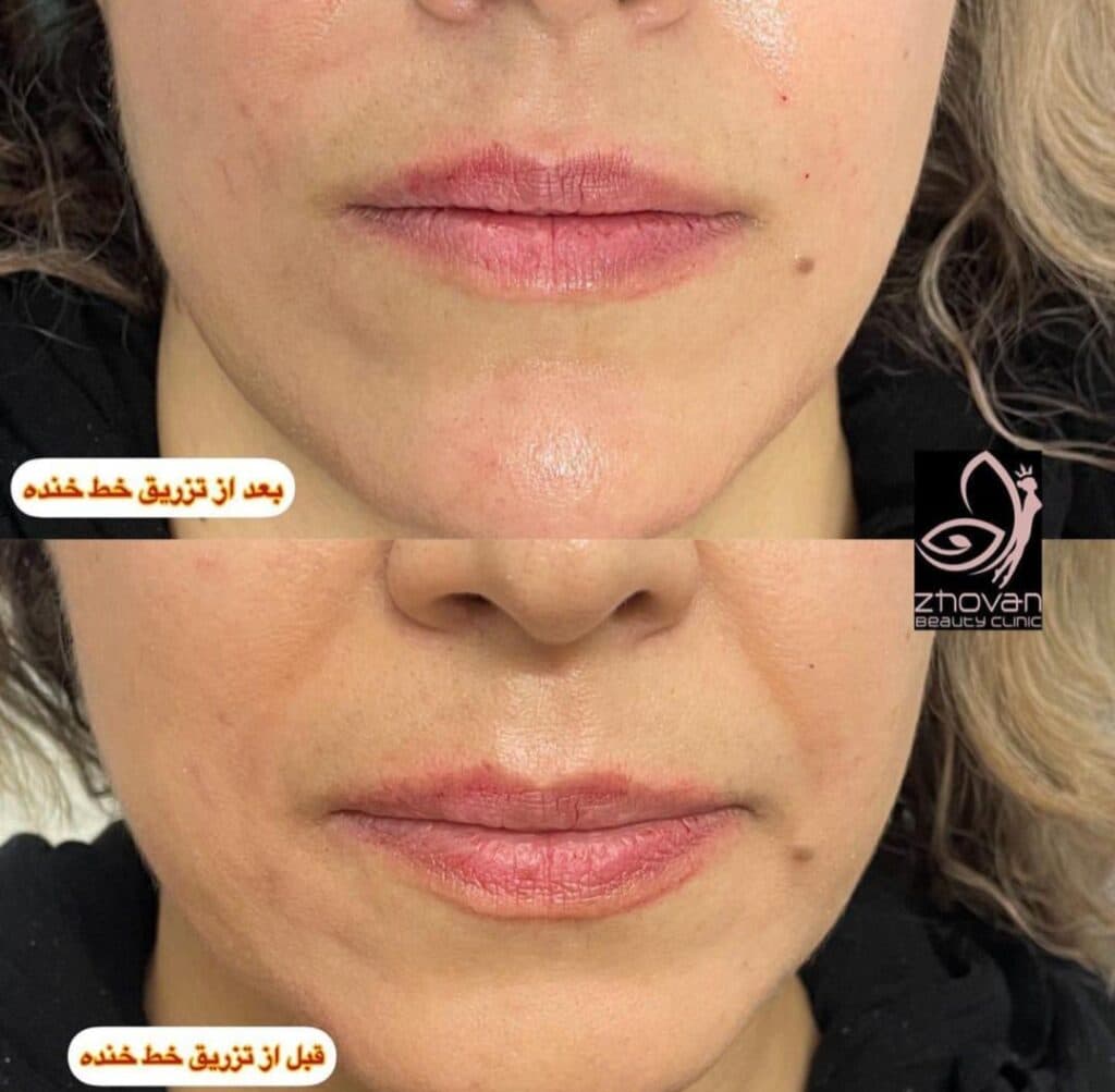 کلینیک تخصصی زیبایی ژوان Zhovan در قدوسی غربی شیراز