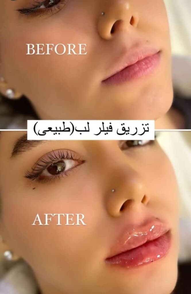 کلینیک زیبایی دنیز در ورامین