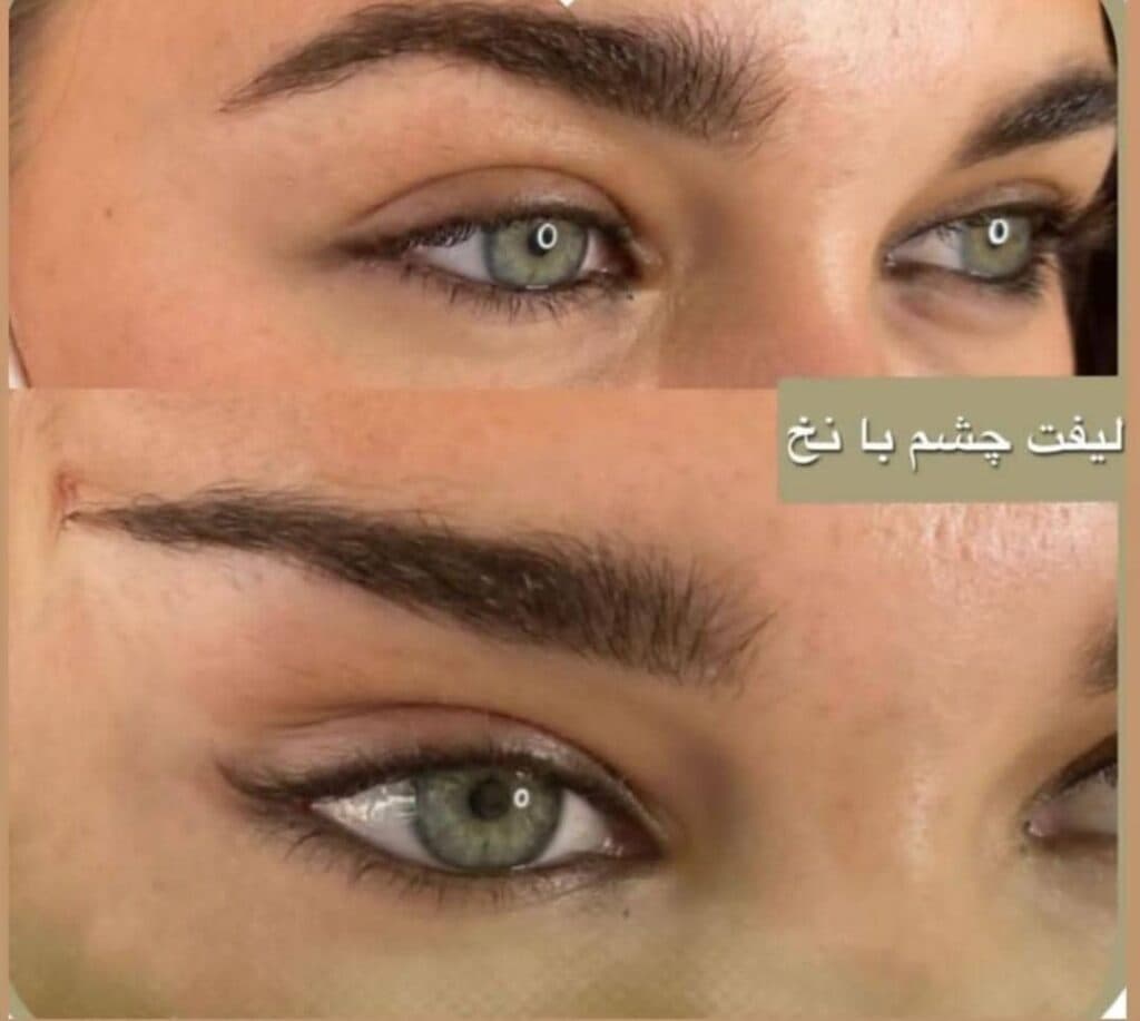 کلینیک زیبایی دنیز در ورامین