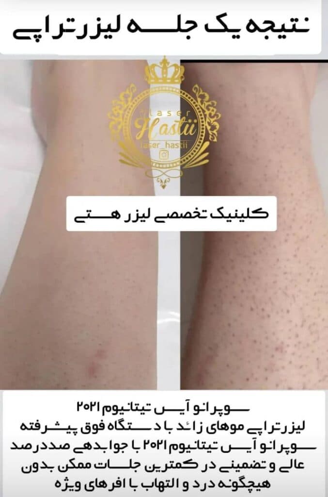 کلینیک تخصصی لیزر هستی در اهواز