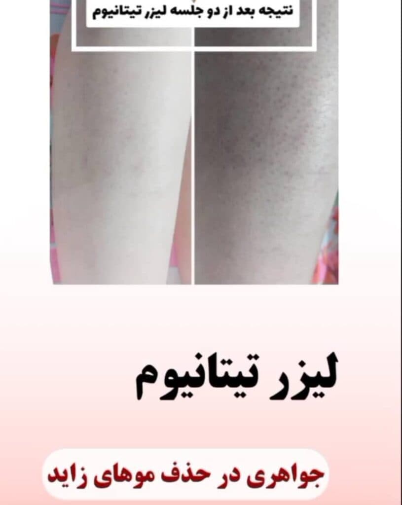 کلینیک تخصصی لیزر هستی در اهواز