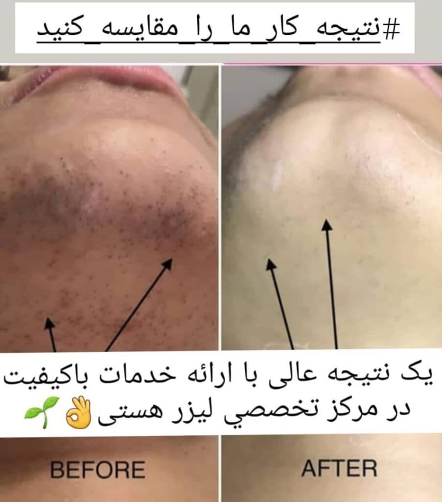 کلینیک تخصصی لیزر هستی در اهواز