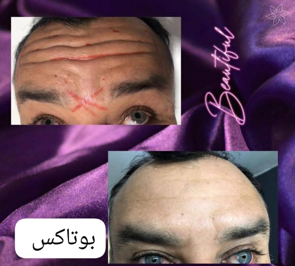 کلینیک زیبایی پوست و مو زیبان در نورآباد