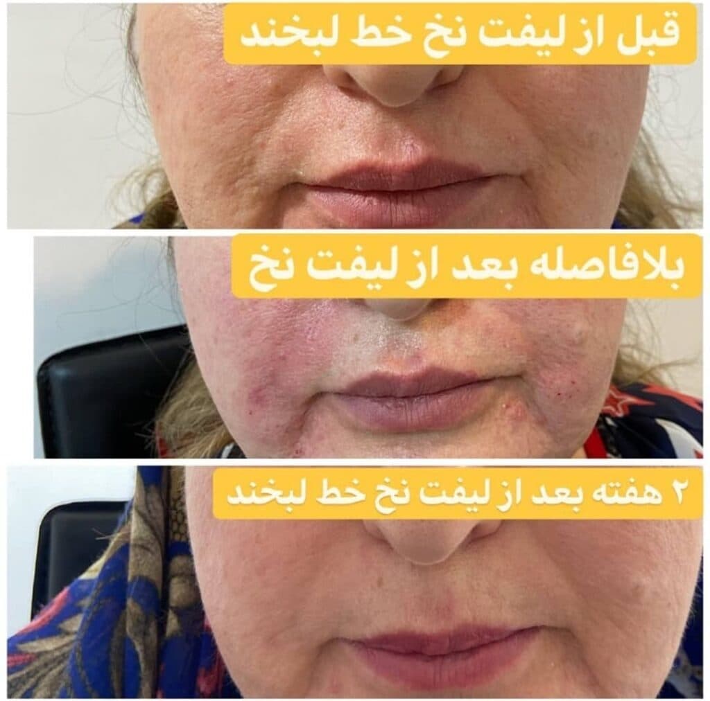 مطب زیبایی ایپک در تبریز
