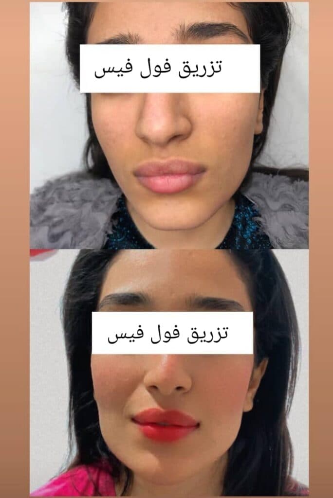 کلینیک زیبایی پوست و مو زیبان در نورآباد