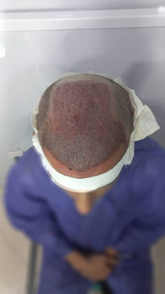 کلینیک کاشت مو وی آر VR در شهریار