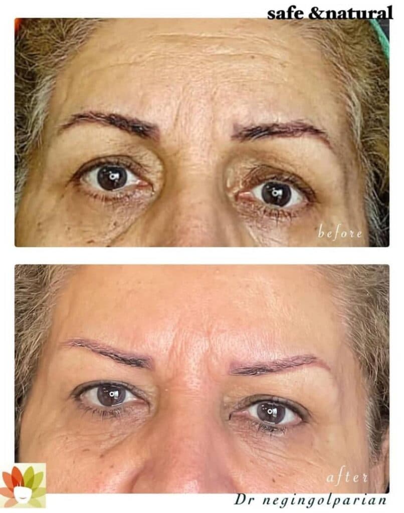 مطب زیبایی پوست و مو دکتر نگین گلپریان در مهرشهر کرج