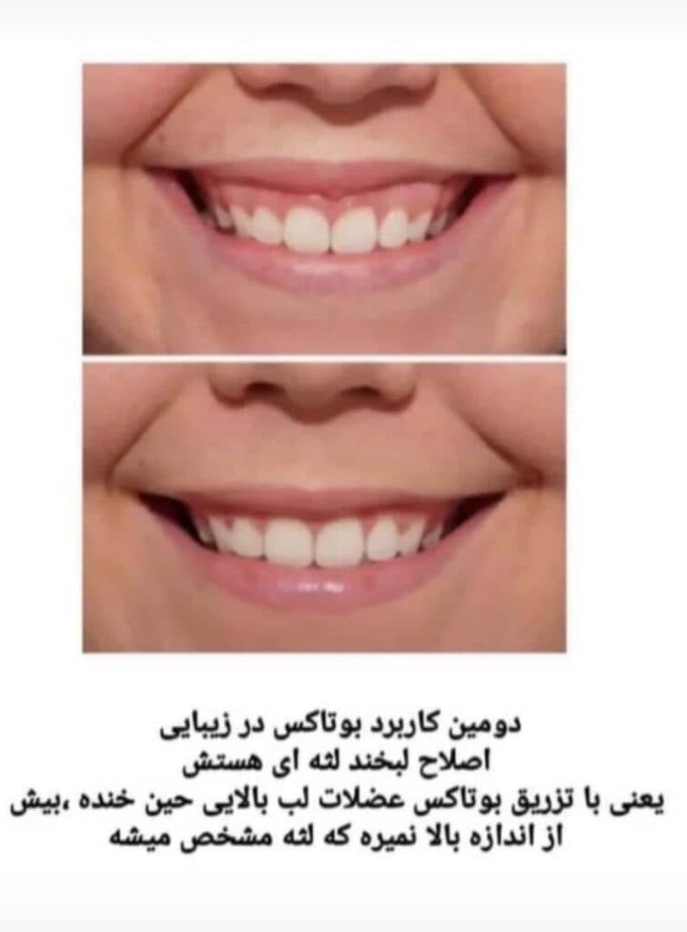 کلینیک لیزر پوست و مو زیبایی ماری اسکین در هفت حوض تهران