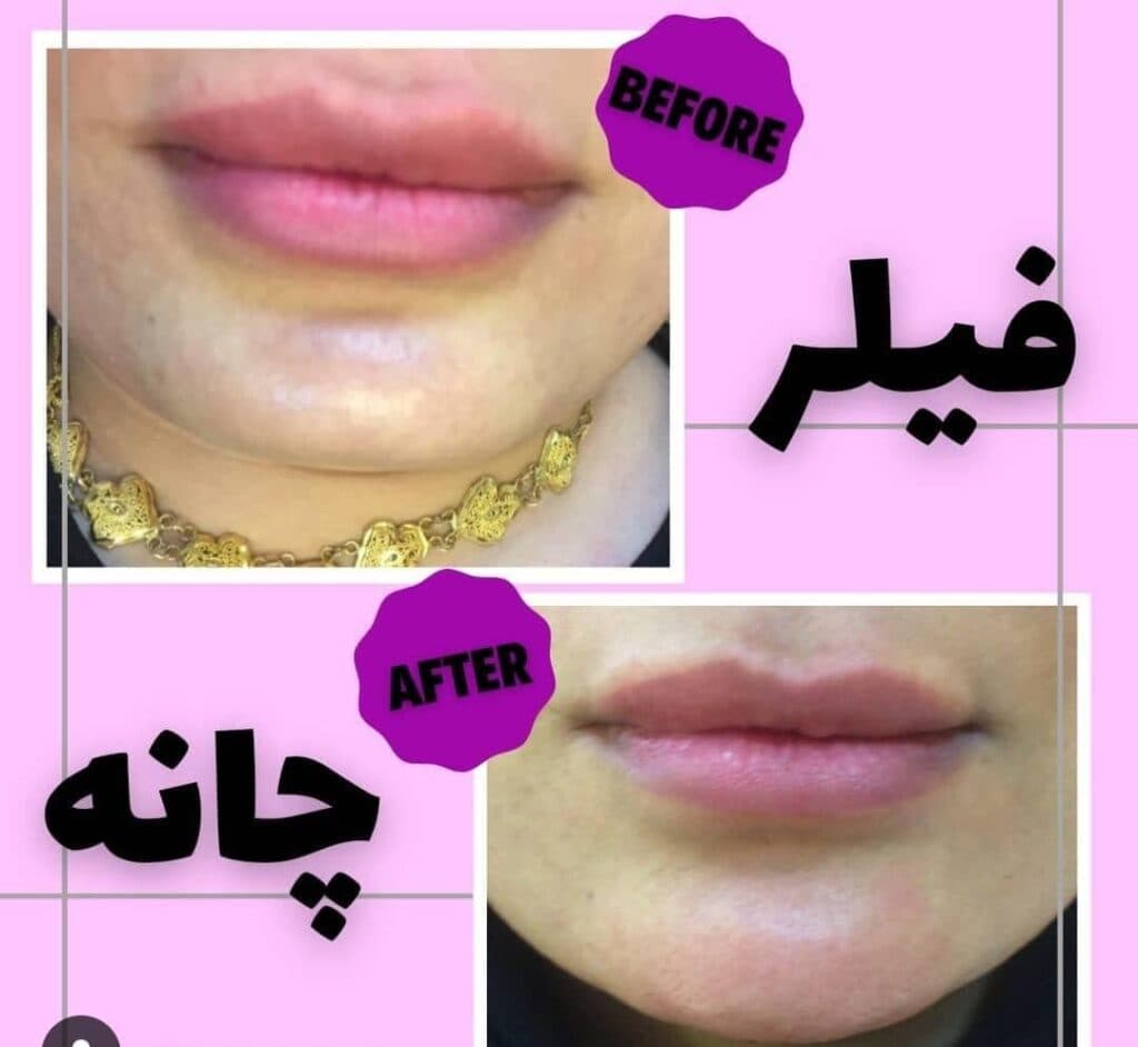 کلینیک زیبایی پوست و مو بدر در بندر ماهشهر