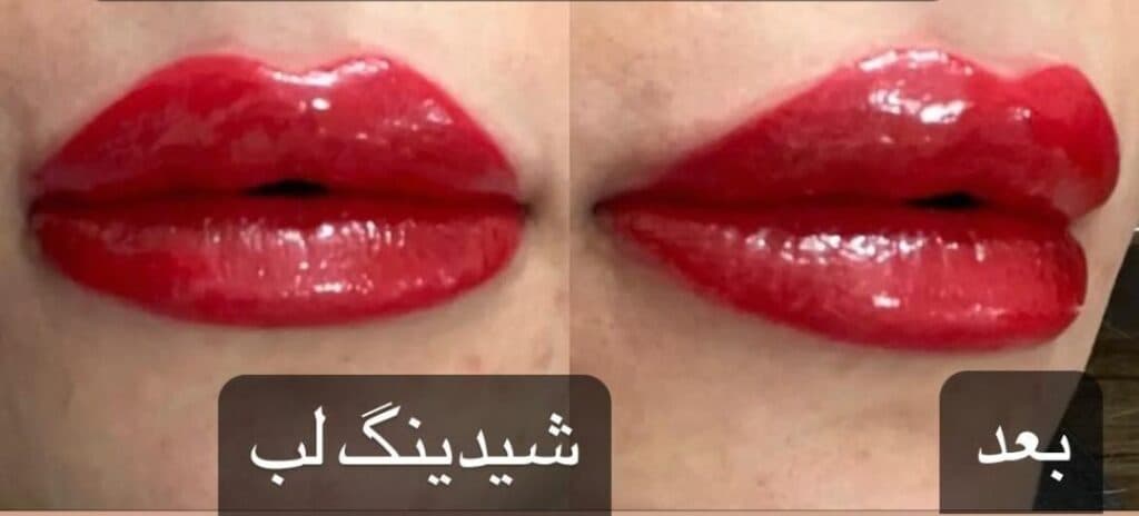 مرکز زیبایی سیندرلا در اردبیل
