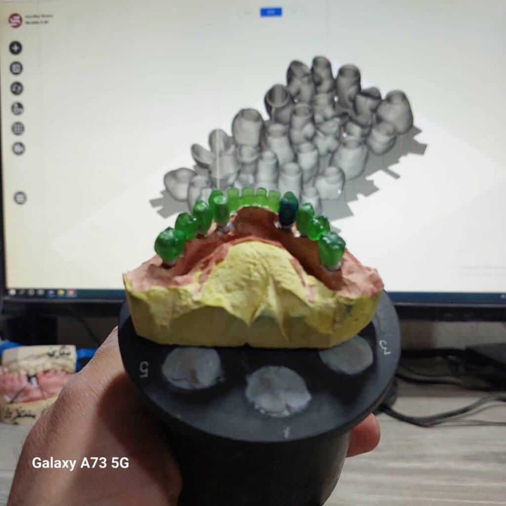 لابراتوار پروتزهای دندانی پارس در رودسر