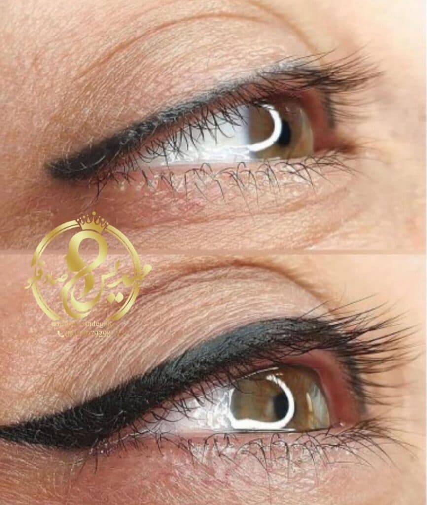 مرکز تخصصی میکروبلیدینگ و ریموو ابرو مهدیس صادقلو در گنبد کاووس