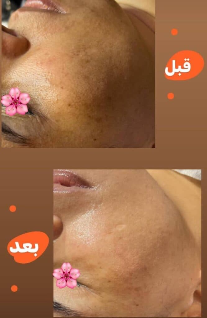 آموزش و خدمات تخصصی پاکسازی پوست لیلا محمدیان در اهواز