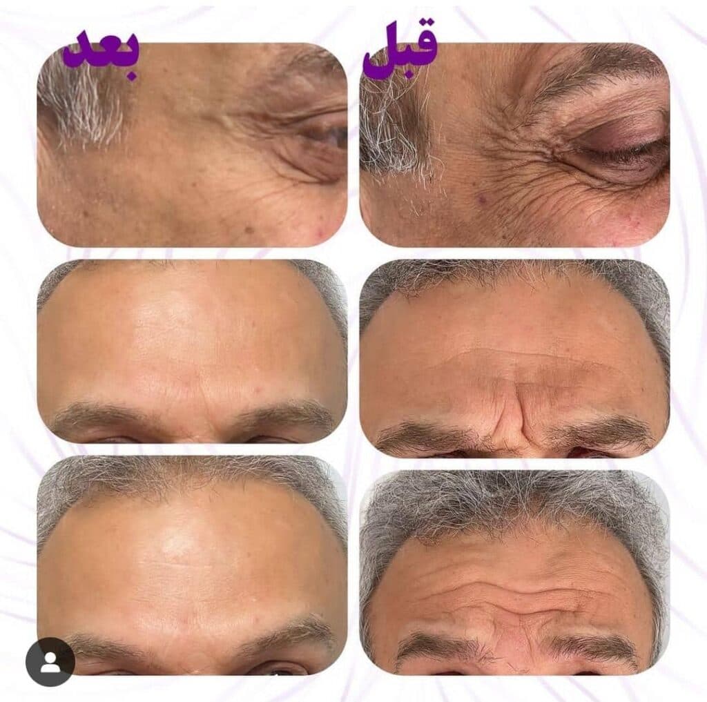 کلینیک زیبایی پوست و مو نلا در رشت