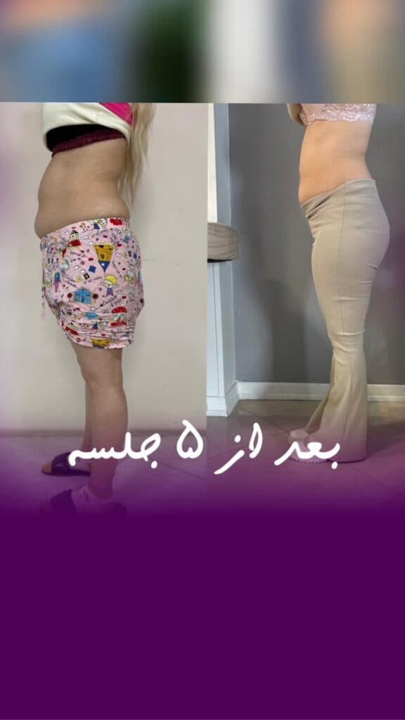 کلینیک لاغری تیروژ در اراک