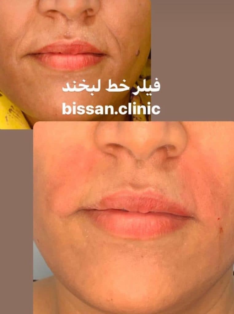 کلینیک زیبایی پوست و لیزر بی سان در بندرعباس