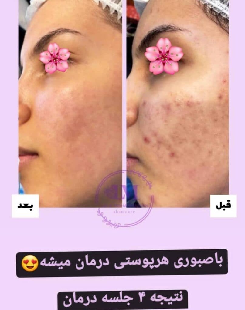 آموزش و خدمات تخصصی پاکسازی پوست لیلا محمدیان در اهواز