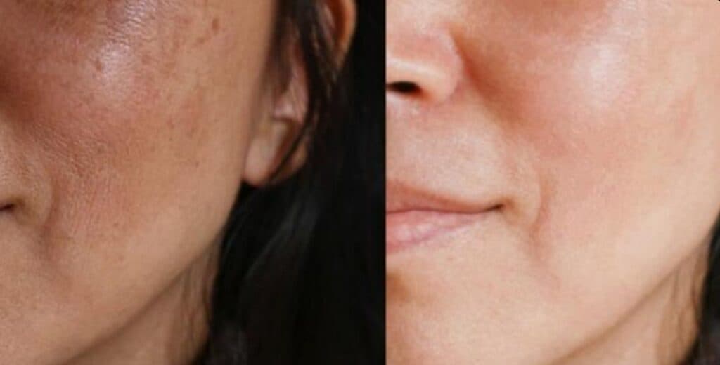 کلینیک لاغری تیروژ در اراک