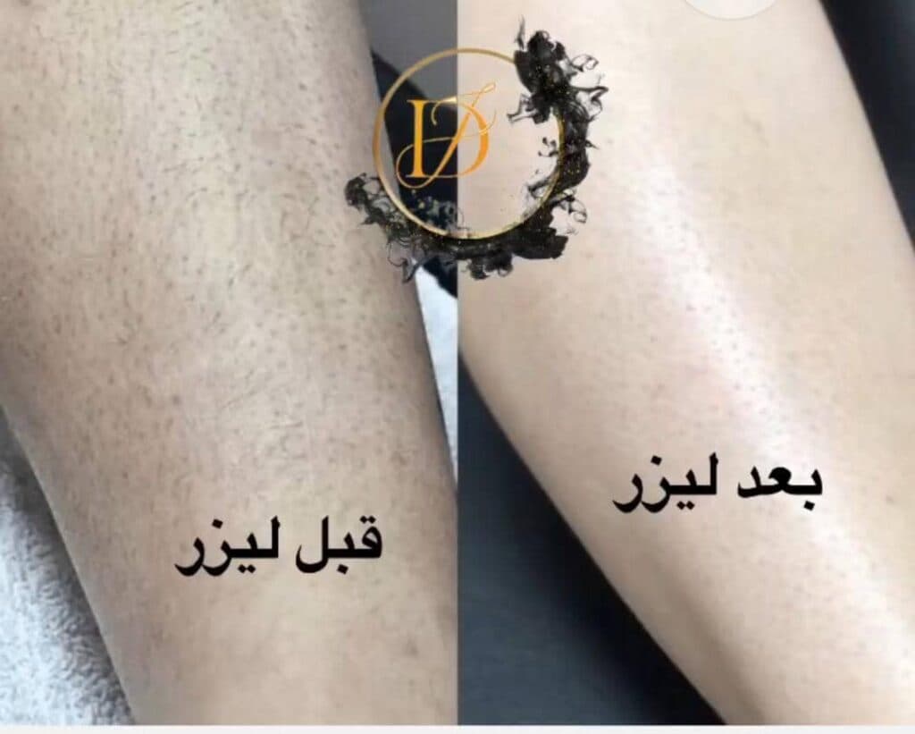 کلینیک تخصصی پوست و مو دریا در تبریز