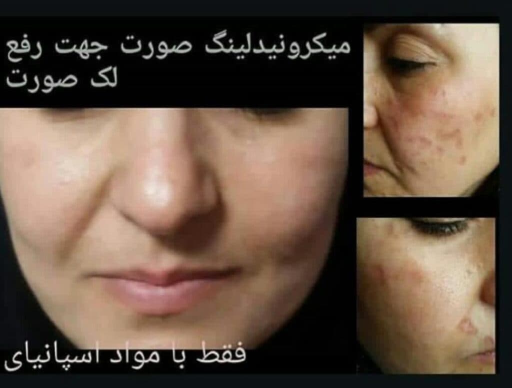 کلینیک زیبایی و لیزر زیبارویان در قم