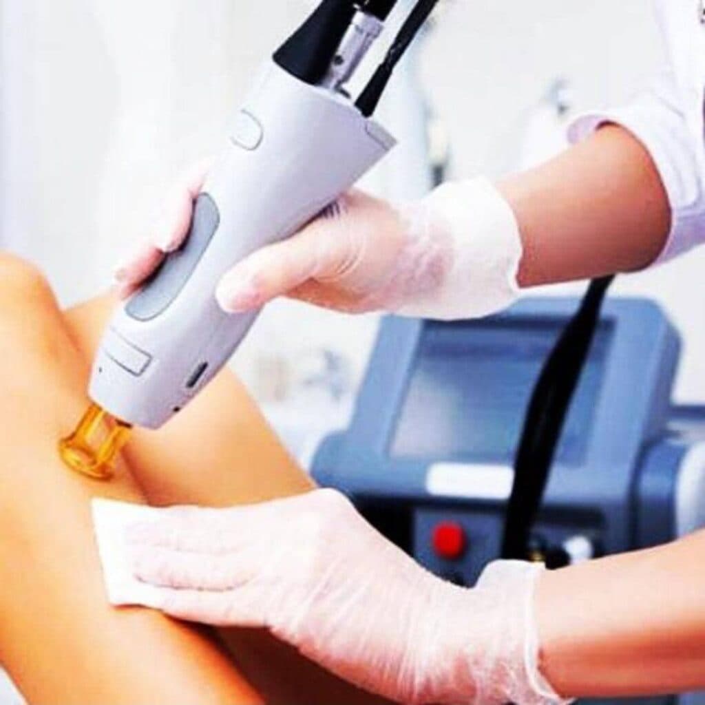 لیزر موهای زائد رضایی در کمالشهر کرج