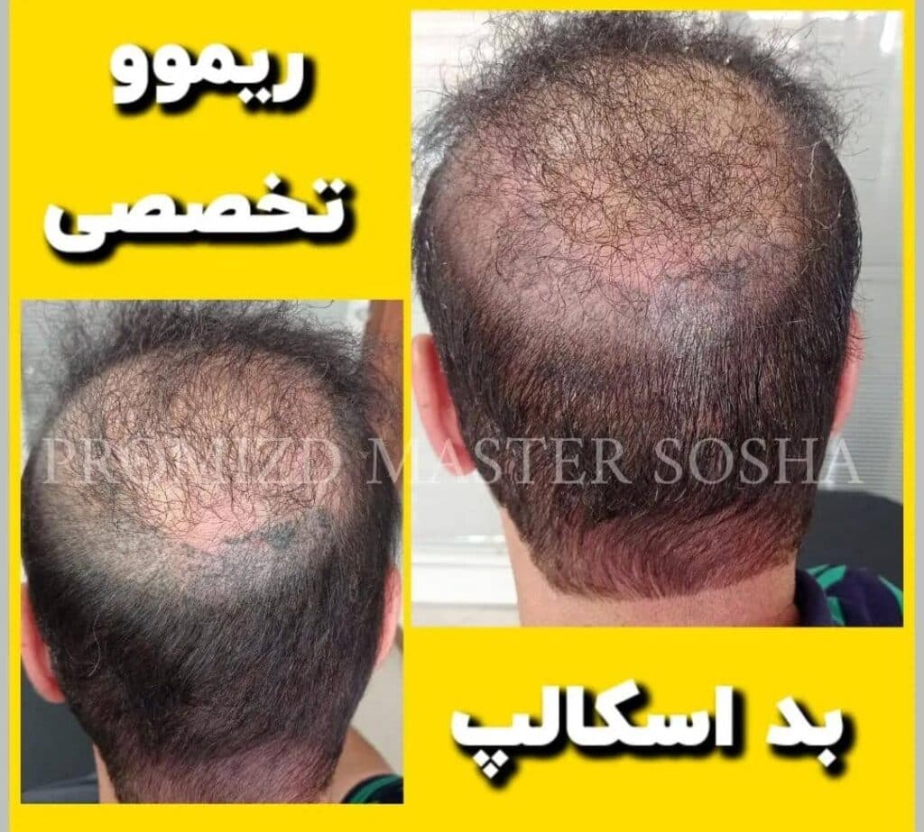 مرکز آموزش و خدمات میکرواسکالپ و اسکالپ سر سوشا احمدی در تهران