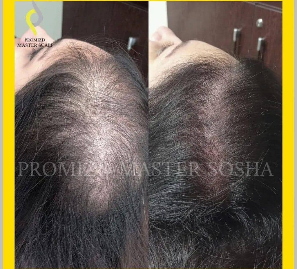 مرکز آموزش و خدمات میکرواسکالپ و اسکالپ سر سوشا احمدی در تهران