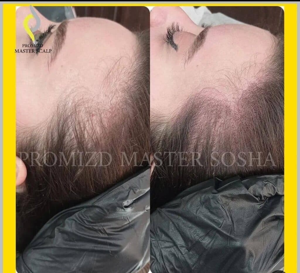 مرکز آموزش و خدمات میکرواسکالپ و اسکالپ سر سوشا احمدی در تهران