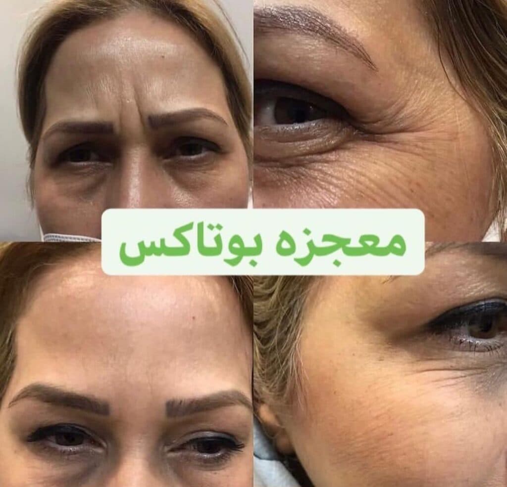 کلینیک زیبایی و لیزر سلین در عدالت گرگان