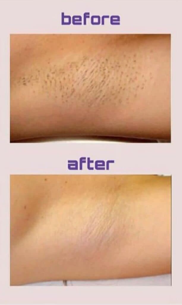 کلینیک زیبایی و لیزر سلین در عدالت گرگان