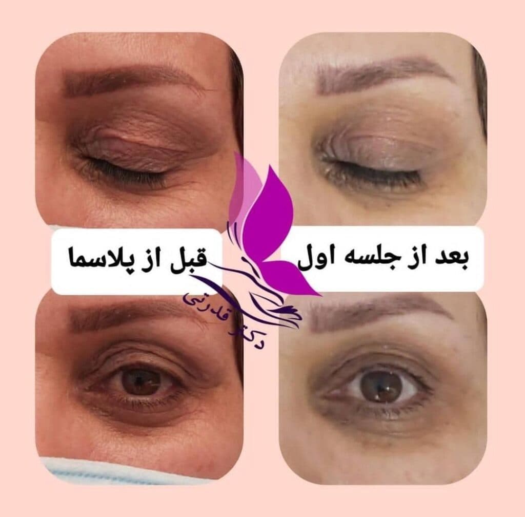 مطب زیبایی و لیزر دکتر فاطمه قدرتی در شیراز