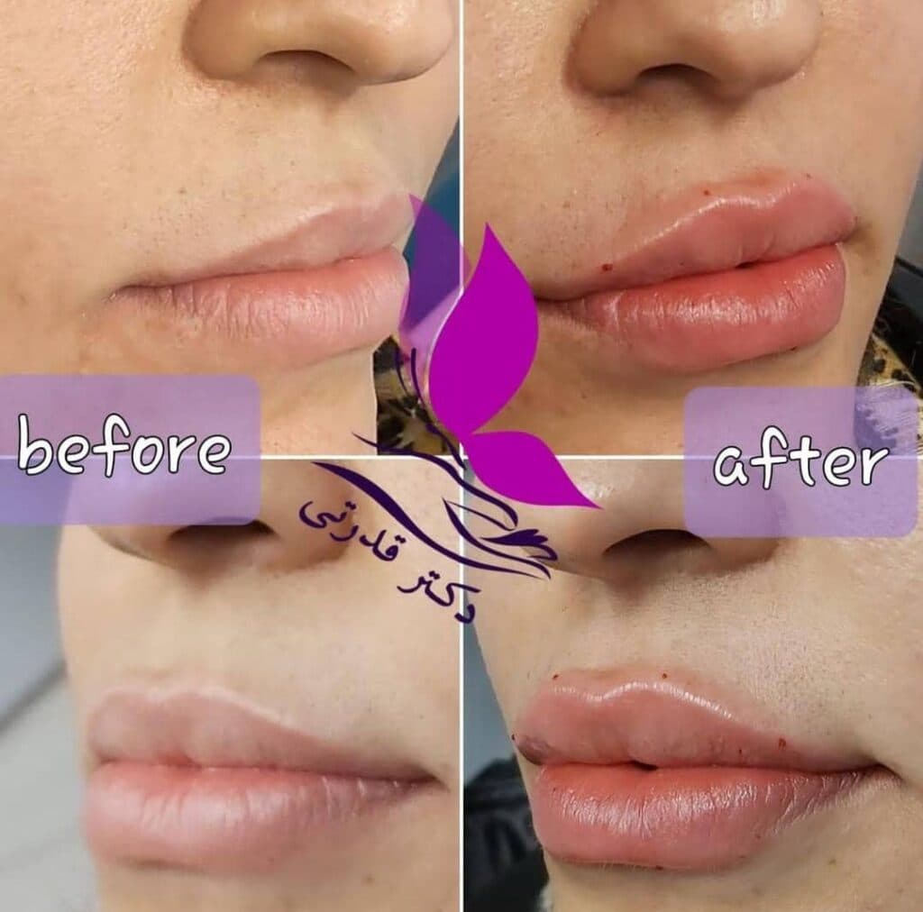 مطب زیبایی و لیزر دکتر فاطمه قدرتی در شیراز