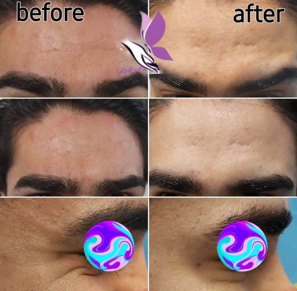 مطب زیبایی و لیزر دکتر فاطمه قدرتی در شیراز