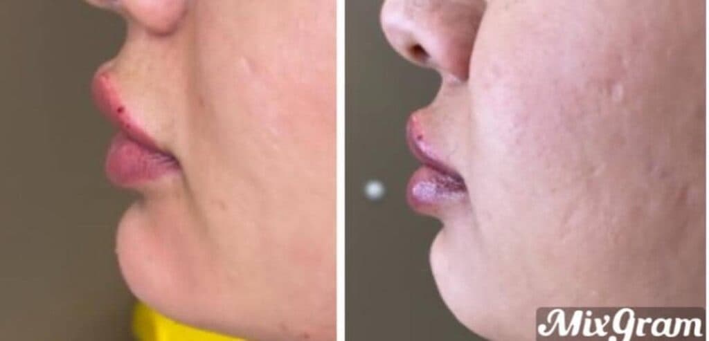 مطب زیبایی دکتر الهام حلوانی در یزد